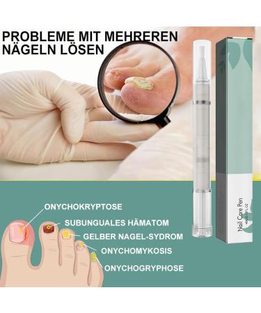 4-Piece Nail Care Pen Set with Tea Tree Oil Vitamin E & Aloe Vera - Well-Groomed Fingernails & Toenails - Includes Nail File - Green - Buy Online on SooperMarket.com