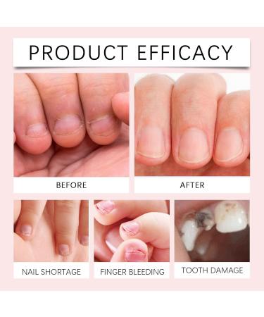 Anti Nail Biting Nail Polish Quick Drying Nail Biting Prevention No Bite Nail Polish Stop Biting Nail Nail Biting Prevention for Adults Clear Anti Nail Biting Polish Stop Nail Biting Nail Varnish - Buy Online on SooperMarket.com