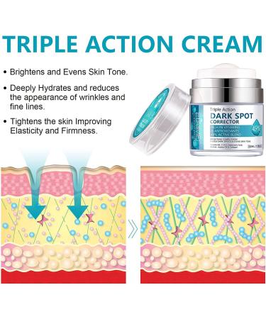 Dark Spot Remover Cream for Face & Body 50ml Dark Spot Corrector with Arbutin and Niacinamide Prevent Forming Dark Spots Fade Spots Reduces Hyperpigmentation Improve Skin Tone - Buy Online on SooperMarket.com