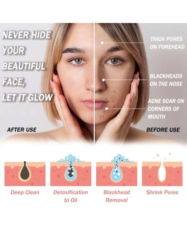 Dead Sea Mud Mask Clay Mask with Aloe Vera Spa Quality Natural Facial Mask Deep Pore Reducer for Face and Body Acne Blackheads Blemish Oily Skin Wrinkles Vegan Cruelty-Free Cosmetic Mineral-Rich - Buy Online on SooperMarket.com