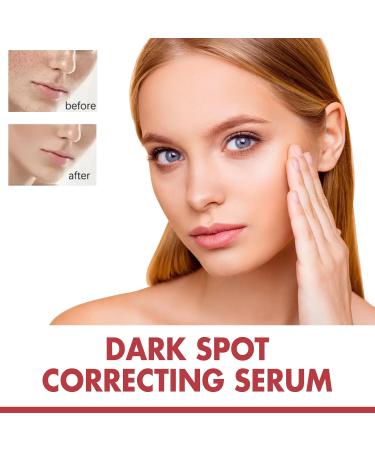 Tongyend Dark Spot Serum Brightening Serum Niacinamide Serum Faded Cream For Dark Spots Dark Spot Corrector For Face Age Spot Remover For Face Face Redness Remover Arbutin Serum Acne Scar 30ml - Buy Online on SooperMarket.com