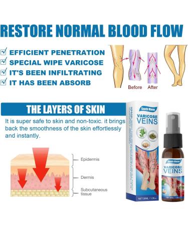 2pcs Veinhealing Varicose Veins Treatment Spray Veinhealing Varicose Veins Spray Vein Healing Varicose Veins Treatment Spray for Legs Varicose Veins Miracle Spray (30ml) - Buy Online on SooperMarket.com