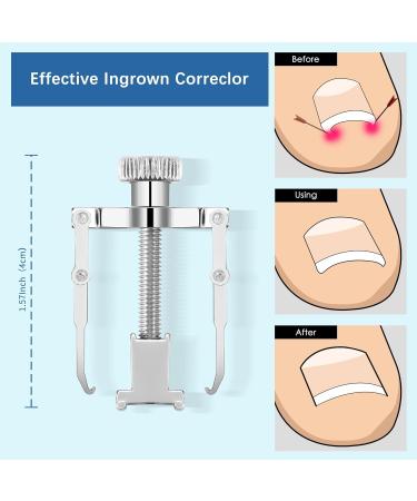 HEYMKGO 9 in 1 Professional Toenail Clippers Set - Heavy Duty Podiatrist Tools for Thick or Ingrown Nails Treatment - Buy Online on SooperMarket.com