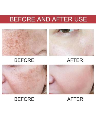 Trendyfave Dark Spot Serum Niacinamide Serum Brightening Serum 10% Niacinamide+ 4% Tranexamic Acid Dark Spot Corrector For Face Age Spot Remover For Face Face Redness Remover Arbutin Serum - Buy Online on SooperMarket.com