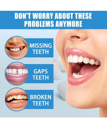 Tooth Repair Kit/Cavity Filler for Teeth/Tooth Repair Granules/Tooth Repair Kit for Chipped Teeth/Moldable False Teeth/Cavity Filler for Teeth/Temporary Filling for Tooth(30g) - Buy Online on SooperMarket.com