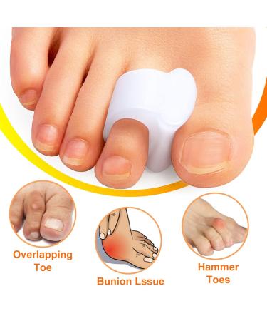 Anggrek Gel Toe Separators - 6 Pairs Silicone Relief Bunion Pain Corrector for All Shoes - Blue/White - Buy Online on SooperMarket.com