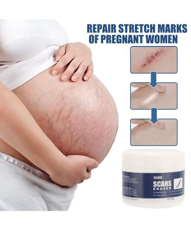 Scar Gel - Skin Repair and Removal Treatment for Face, Body, Surgery, Burns, Stretch Marks - Buy Online on SooperMarket.com