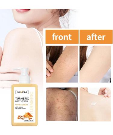 FAYNDE Turricum Body Cream 100ml - Nourishing Daily Skin Care with Ginger Extract for Women & Teens | Ideal for Back Neck Shoulders Arms & Legs - Buy Online on SooperMarket.com
