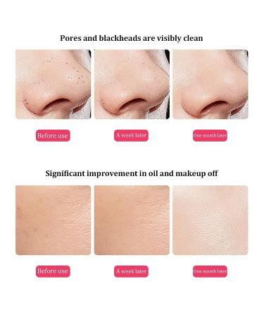 Skin Scrubber Blackhead Removal Exfoliating Facial Spatula for Deep Cleansing - Buy Online on SooperMarket.com