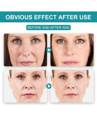 Trendyfave Retinol Moisturiser Cream Collagen Face Cream with Retionl 5% Hyaluronic Acid and Vitamin E Smoothes Wrinkles Day and Night Cream Firming Retinoid Cream - Buy Online on SooperMarket.com