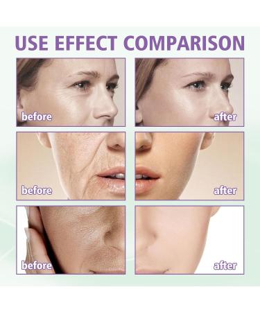 Hyaluronic Acid Serum for Face Face Serum Skincare for a Rejuvenated Skin - Collagen Serum for Face for Sensitive Skin - Buy Online on SooperMarket.com