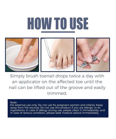 German Toenailcare Removal Paronychia Oil - Repair Damaged Discolored Thick Nails - 2 Pcs - Buy Online on SooperMarket.com