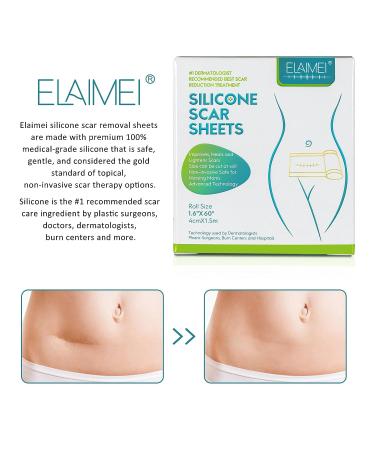 WUHEMA Silicone Scar Tape Roll - Soften, Flatten, and Remove Scars - Reusable and Washable - for Acne, Cesarean Section, Keloid, and Surgery Scars - Buy Online on SooperMarket.com