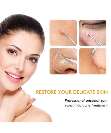 Blackhead Remover Kit - 7-Piece Pimple Extractor Tool Set for Facial Acne Treatment - Blemish Whitehead Popping Zit Removal - Metal Case Included - Buy Online on SooperMarket.com