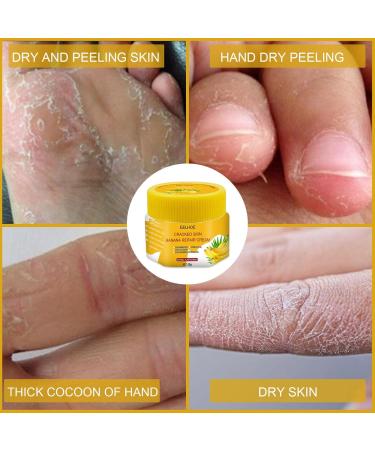 Foot Care Shooting Ointment | Moisture Cream for Rough Skin | Gentle Care Cream for Dry Hands | 2PCS 1g - Yellow Pack - Buy Online on SooperMarket.com