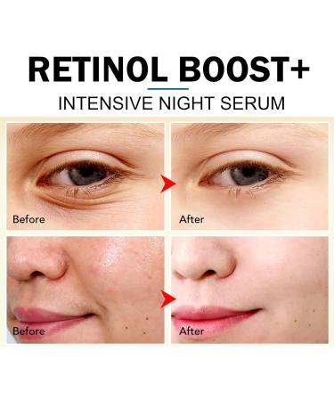 Retinol Face Night Serum Anti Wrinkle Serum Retinol Serum for Face Retinol Face Serum Face Moisturizer for Women Hydrating Serum Dark Spot Remover Anti Age Serum Plump and Smooth Skin - Buy Online on SooperMarket.com