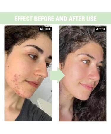 Panthenol Face Serum Niacinamide Serum Brightening Serum Hydrating Serum Korean Serum For Repair Dark Spot Corrector For Face Calming Serum Green Tea+Hyaluronic Acid Panthenol Cream - Buy Online on SooperMarket.com