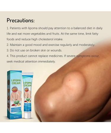 Lipoma Removal Cream 20g - Natural Treatment for Lipoma Care & Discomfort - Buy Online on SooperMarket.com