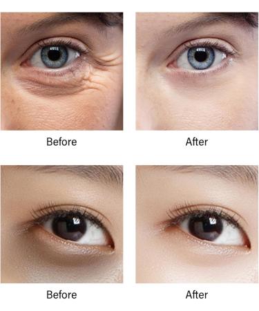 Retinol Eye Cream Anti Aging Eye Cream For Wrinkles AHA 30% Repair Eye Cream For Dark Circles And Puffy Eyes Under Eye Cream For Dark Circles Hydrated Smooth Firming Lift Skin - Buy Online on SooperMarket.com