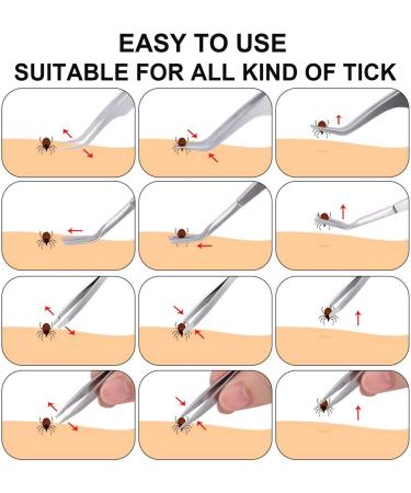 EasyULT 3PCS Tick Remover Tool Set Tick Removal Tool Stainless Steel Tick Remover Tick Hook Kit Included Removal Tweezers+ Tick Shovel for Animals for Humans Dogs Cats 3Pi ces - Buy Online on SooperMarket.com