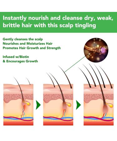 Hair Growth Serum & Rosemary Shampoo - Biotin & Castor Oil for Hair Loss | Effective Regrowth Products for Women & Men - Buy Online on SooperMarket.com