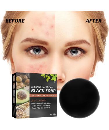 Nmbol Skin Acne Soap Soap for Removal of Black Spots ening Soap for Dark Skin Natural Soap Face Body Fixed Facial Cleaning Vegan For All Skin Types - Buy Online on SooperMarket.com