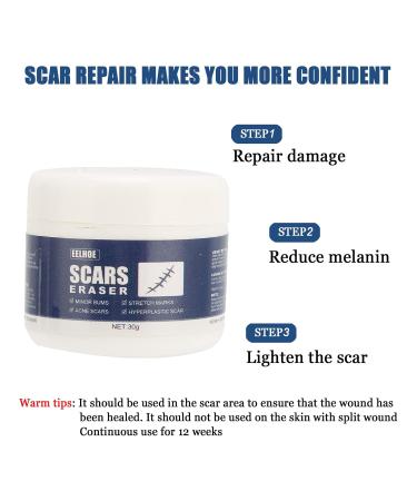 Scar Gel - Skin Repair and Removal Treatment for Face, Body, Surgery, Burns, Stretch Marks - Buy Online on SooperMarket.com