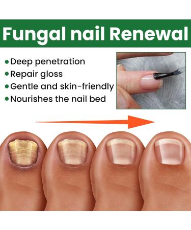 MrCuvaryas Nail Serum for Toenails Extra Strong - Buy Online on SooperMarket.com