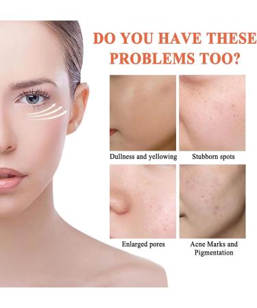 20% Vitamin C Serum for Face with Hyaluronic Acid Reduce Pigmentation for Face Boost Skin Collagen Anti Aging & Wrinkle Facial Serum Brighten Hydrate & Plump Skin Dark Spot Remover for Face - Buy Online on SooperMarket.com