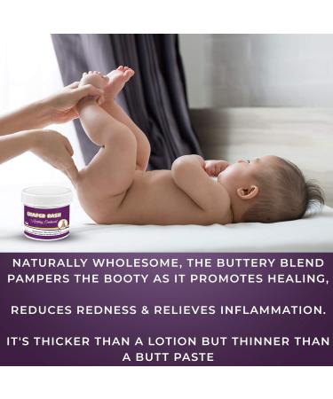 Natrulo All Natural Diaper Rash Healing Ointment 2oz - Hypoallergenic Organic Butt Balm for Quick Itch Relief - Soothing Vegan Bum Lotion for Baby, Kids, Adults - Buy Online on SooperMarket.com