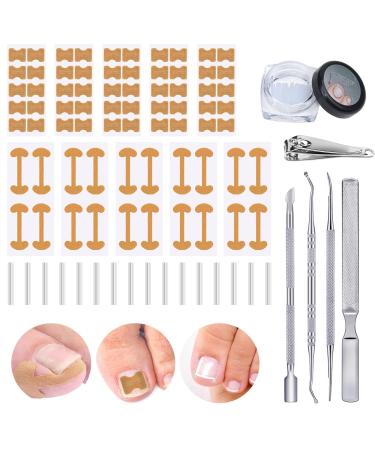 105 pieces of ingrown toenails tool set pedicure set with an ingrown correction sticker nail tongs nail slide nail files nail folding tamponade tube