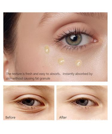 Retinol Eye Serum - Anti-Aging Under Eye Cream for Wrinkles & Fine Lines | Tightening & Firming | Double Retinol 30ml - Buy Online on SooperMarket.com