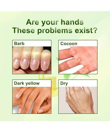 Hands Moisturizing Mask - Ultimate Hand Care for Whitening & Dry Skin Relief | Hydrating Skin Care Treatment - Buy Online on SooperMarket.com