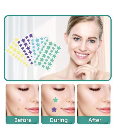 112 Counts Star-Shaped Pimple Patches - Hydrocolloid Acne Stickers for All Skin Types - Effective Pimple Patch Set - Buy Online on SooperMarket.com