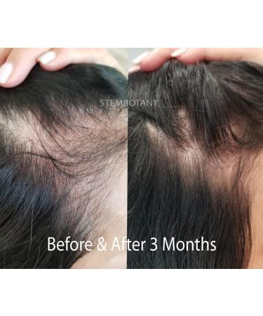GHK-cu Copper Peptide Hair Regrowth Shampoo for Men & Women - Boost Hair Growth Nourish & Revitalize Shop Internationally - Buy Online on SooperMarket.com
