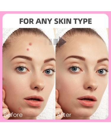 EFLY Hydrocolloid Pimple Patches with Tea Tree Oil & Salicylic Acid Invisible Acne Dots for Face 210 Patches - Buy Online on SooperMarket.com