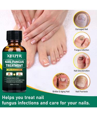 XIFEPFR Toenail Repair Treatment - Extra Strength Nail Renewal Solution for Thick, Brittle, and Discolored Nails - Buy Online on SooperMarket.com