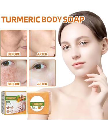 Nmbol Skin Turmeric Soap Cojic Acid Soap For Skin Lightening Kurkuma Soap Lightening Solid Facial Soap Handmade Organic Natural Soap Soap For Dark Spots Hyperpigmentation Smooth Skin - Buy Online on SooperMarket.com