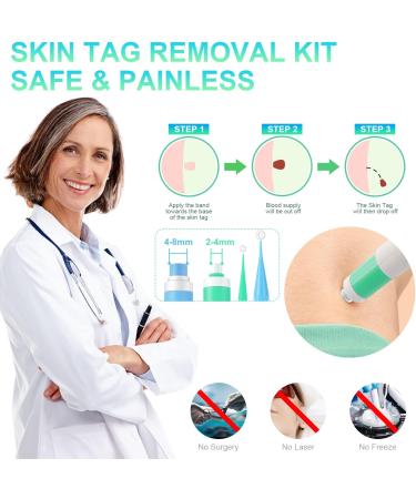 New Version Auto Skin Tag Remover Kit 2-Set Painless Skin Tag Removal Kit Tools for (1-9mm) Skin Tags (includes 100 Removal Bands & 36 Repair Patches & 20 Pcs Cleansing Wipes) Blue Green 2pcs Kit - Buy Online on SooperMarket.com