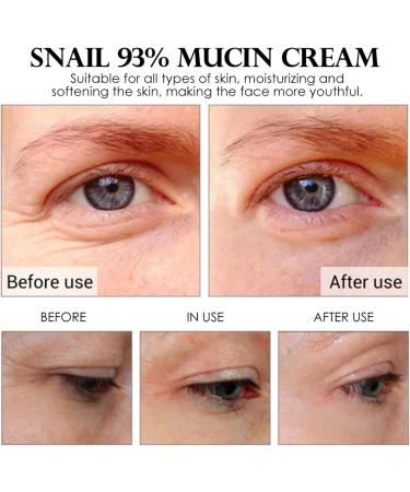Snail Mucin Moisturiser Snail Cream Snail Mucin Cream with Hydrolyzed Collagen and Snail Filtrate Extract Anti Aging Face Cream for Hydrating Anti Wrinkles - Smooth Fine Lines - Anti Aging - Buy Online on SooperMarket.com