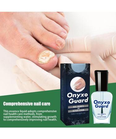  1/2/3/4/5/6 Nail Conditioner for Damaged Nails Nail Strengthener for Weak Nails Onyxoguard Nail Growth and Repair Serums Essence Nail Hardener Extra Strong and Growth Nail Guards for Strength - Buy Online on SooperMarket.com