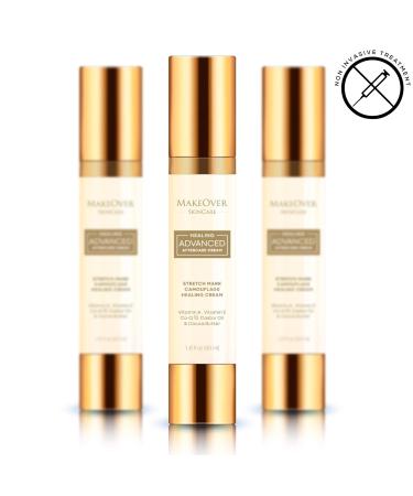 Healing Advanced Aftercare Cream - Organic Stretch Marks & Scar Treatment - Vitamin A E Castor Oil & Cocoa Butter - 50ml Belly Butter for Improved Circulation - Non-Invasive Care - Buy Online on SooperMarket.com