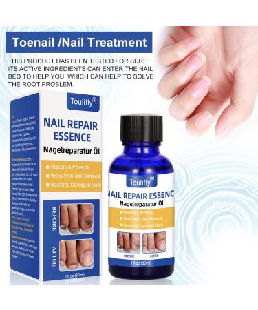 Premium Nail Care & Treatment | Repair Broken & Discolored Nails with Nourishing Nail Oil & Serum for Healthy Hands & Feet - Buy Online on SooperMarket.com