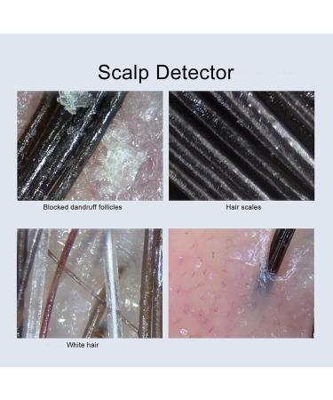 3MP Scalp Detector Portable Skin Dignosis Detector Handheld Intelligent Hair Follicle Analyzer Good for Solving Scalp and Hair Follicle Problems - Buy Online on SooperMarket.com