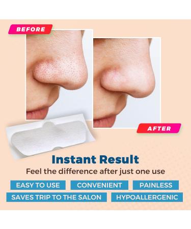 Nose Pore - Blackhead Removing and Pore Unclogging Deep Cleansing Pore Strip Combo Pack 96 Count Strips - Buy Online on SooperMarket.com