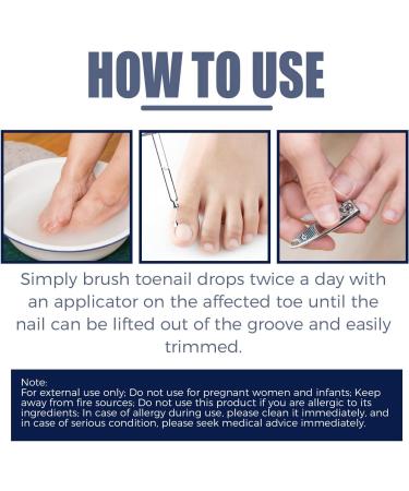Ingrown Toenail Treatment Correction Drops Nail Growth Treatment Nail Care Ingrowing Toenail Treatment Ingrown Toenail Corrector Treatment for Ingrown Toenail Ingrowing Toenail Improve Toenail Health - Buy Online on SooperMarket.com