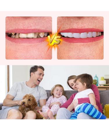 Natural Shade Fake Teeth Veneers Set for Upper and Lower Jaw 6pcs Cosmetic Dentures for Christmas and Daily Use - Buy Online on SooperMarket.com