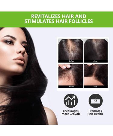 Hair Regrowth Spray Hair Growth Serum for Men & Women Anti Hair Loss Spray with Mint and Ginger Hair Rapid Growth Spray Repair Hair Follicles Hair Regrowth Serum for Bald Spots & Thinning Hair - Buy Online on SooperMarket.com