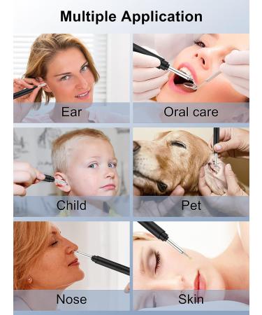 Wireless 1296P HD Ear Wax Removal Tool with Camera and LED Lights - Waterproof Otoscope for iPhone & Android - Black - Buy Online on SooperMarket.com