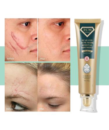 Silicone Scar Ointment 30g - Moisturizing Scar Cream for Smooth, Inconspicuous Scar Removal - Buy Online on SooperMarket.com